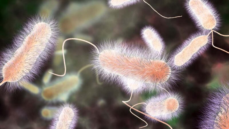 Legionnaires Disease